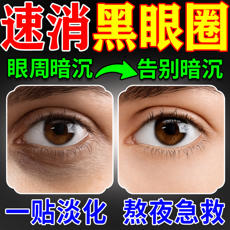 黑眼圈眼贴去黑色素沉淀特别严重淡化眼袋眼周细纹缓解眼疲劳神器