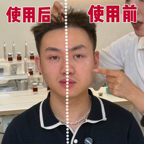 鱼姐夫妇韩国溯源发现的Y美项目 随时开拍！