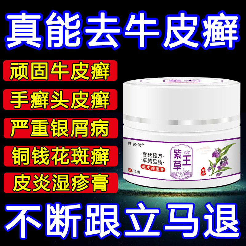 牛皮藓皮肤外用治疗屑手足藓皮肤头止痒去湿根疹股体藓抑菌膏