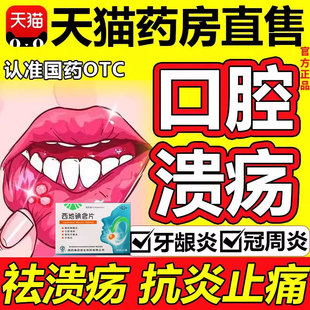 口腔溃疡药特专用效嘴巴上火起泡治疗口舌生疮的药物西地碘含片xl