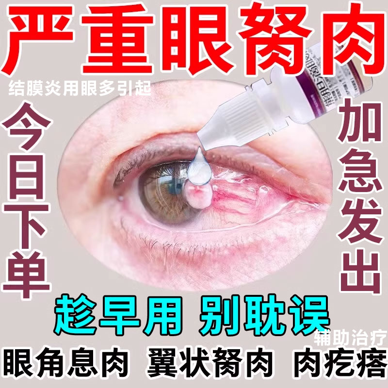 【瑞辉】熊胆滴眼液10ml*1支/盒去眼睛胬肉滴眼液眼睛浑浊看不清有异物翼状息肉疙瘩