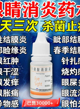 炎结膜炎眼药水止痒消炎杀菌眼睛干涩发痒眼痒沙眼滴眼液眼药水xl