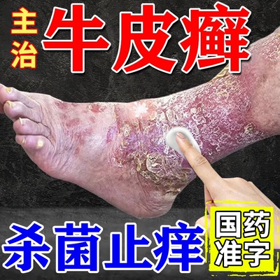 【科田】华佗膏20g*1支/盒牛皮藓银屑病专用药皮肤干燥瘙痒止痒抑菌