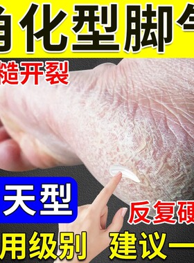角化型脚气药xl止痒脱皮烂脚丫真菌感染手足癣脚后跟增厚硬化干裂