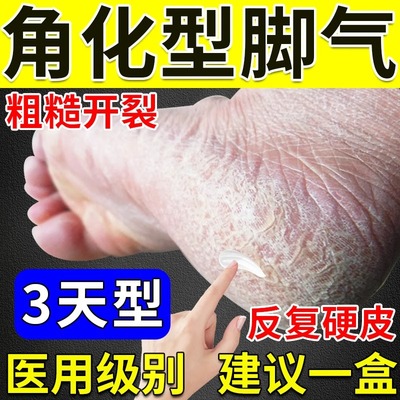 【高邦】硝酸咪康唑乳膏20g*1支/盒⭐【隐私发货】角化型脚气专用药烂脚丫专用药