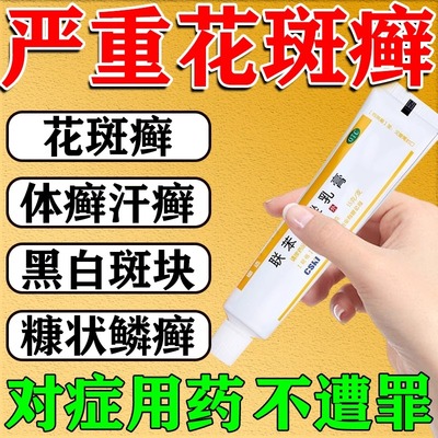 【锄选】联苯苄唑乳膏1%*15g*1支/盒汗斑花斑癣专用药膏快速消白斑手股藓糠疹真菌感