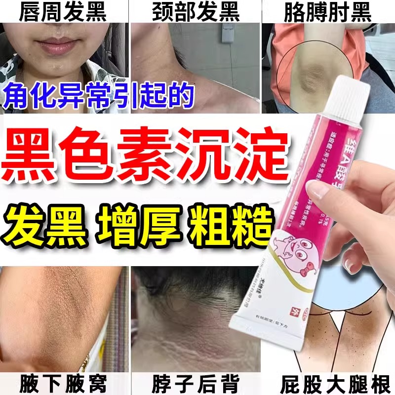 【良福】维A酸乳膏0.1%*15g*1支/盒【维a酸乳胶膏淡化黑色素沉淀】