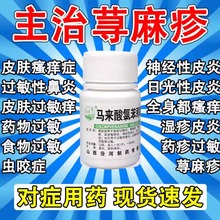 治疗寻荨麻疹过敏止痒特脸断皮肤过敏湿疹瘙痒根止痒效专用药膏xl