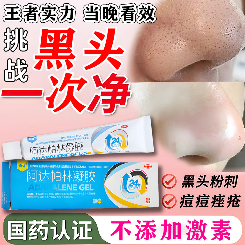 【鑫烨】阿达帕林凝胶0.1%*10g*1支/盒医用去黑头药膏官方旗舰店脸上毛孔粗大粉刺