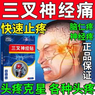 三叉神经药物面部疼痛贴膏顽固性偏头痛头晕三岔神经脸疼牙疼克星
