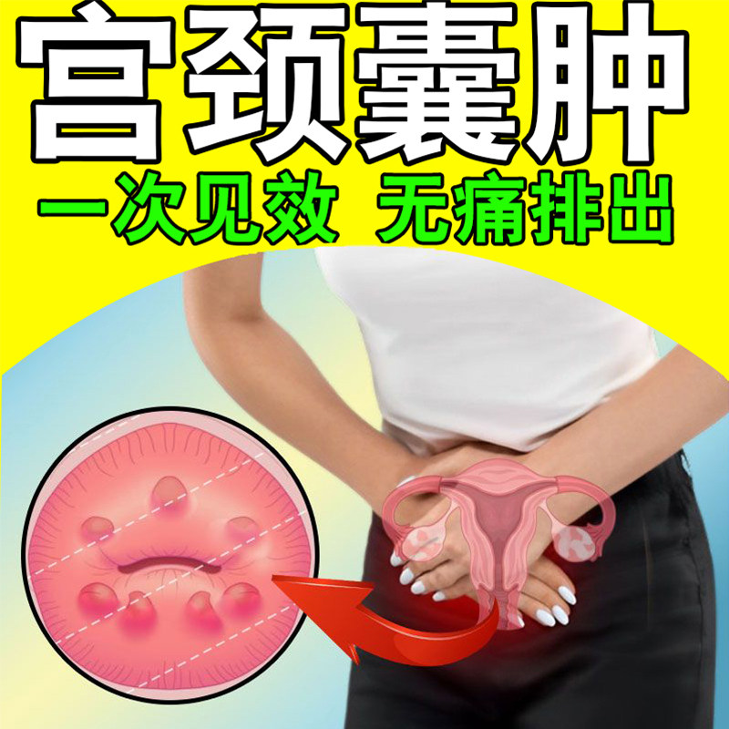 万泽双奇阴道用乳杆菌活菌胶囊万泽双奇定君生粒图片