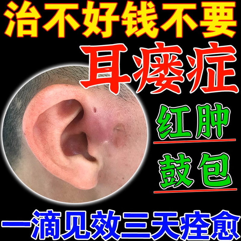 头孢羟氨苄咀嚼片恒健头孢氨苄胶囊粒