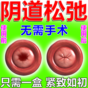 宫颈炎片片适必达盐酸莫西沙星片