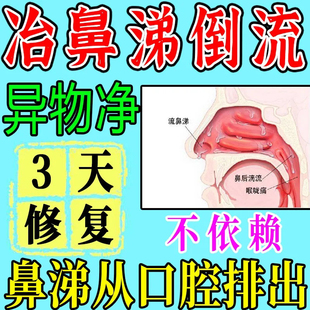 迪康滴通皇炎水迪康滴通皇炎鼻炎水喷雾剂鼻窦炎