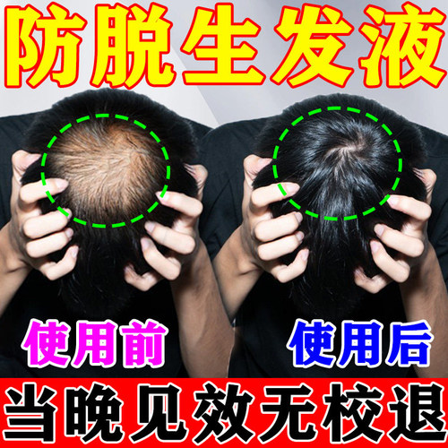 胱氨酸生发美国朴诺生物素防脱发生发发胶囊维生素B7B6胱氨酸