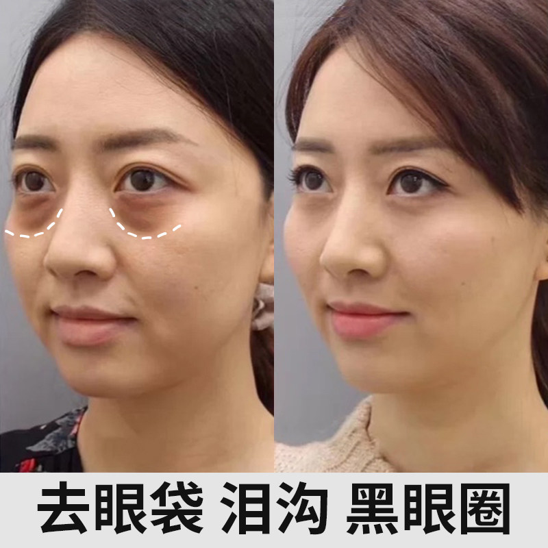 【爆款热卖】眼部丰盈原液 告别泪沟 收缩眼袋神器 买2送1