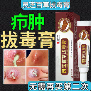疖肿拔毒膏火疖子皮脂腺囊肿拔脓粉瘤去除屁股上长脓包坐疮吸脓头