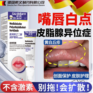 皮脂腺异位症嘴唇白点脂肪小颗粒增生去除唇部干裂脱皮神膏器ON