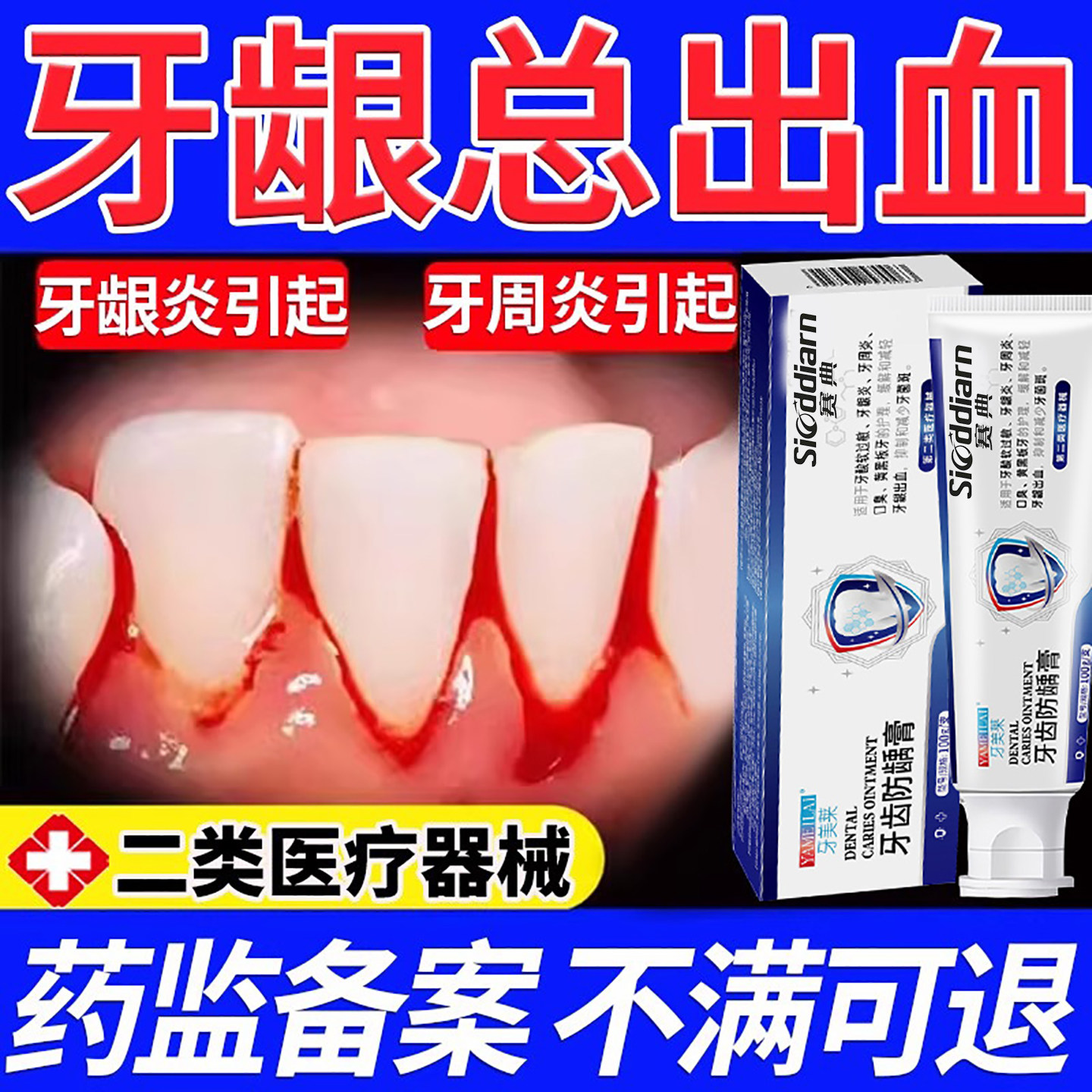 牙龈出血牙周炎牙齿止血口腔的口臭肿痛萎缩漱口水非牙膏YU