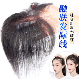 假发女片头顶补真发遮白发蓬松颅顶增发量轻薄无痕自然前额假刘海