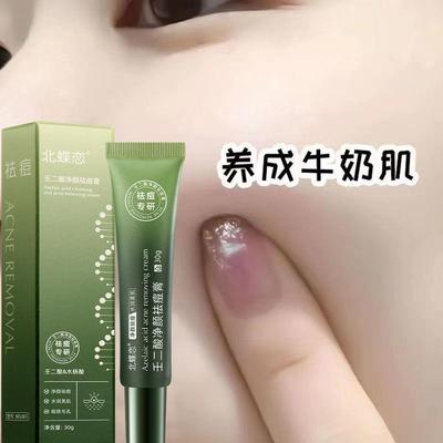 祛痘膏去痘印青春痘粉刺收缩毛孔霜修复淡化痘坑男女学生祛痘神器