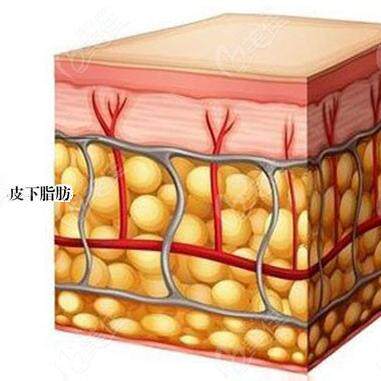 DR【碎脂】漂亮国倍克脂溶溶水G溶+碎+缩韧带重塑技术面+身体