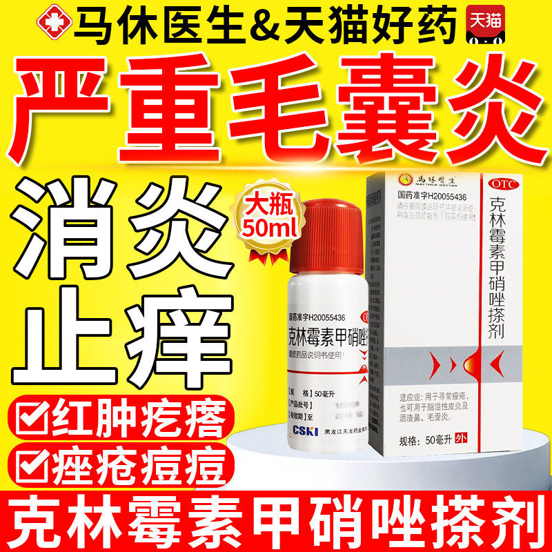 克林霉素甲硝唑搽剂擦剂治头部毛囊炎痘痘马拉色菌药脂溢性皮炎QX