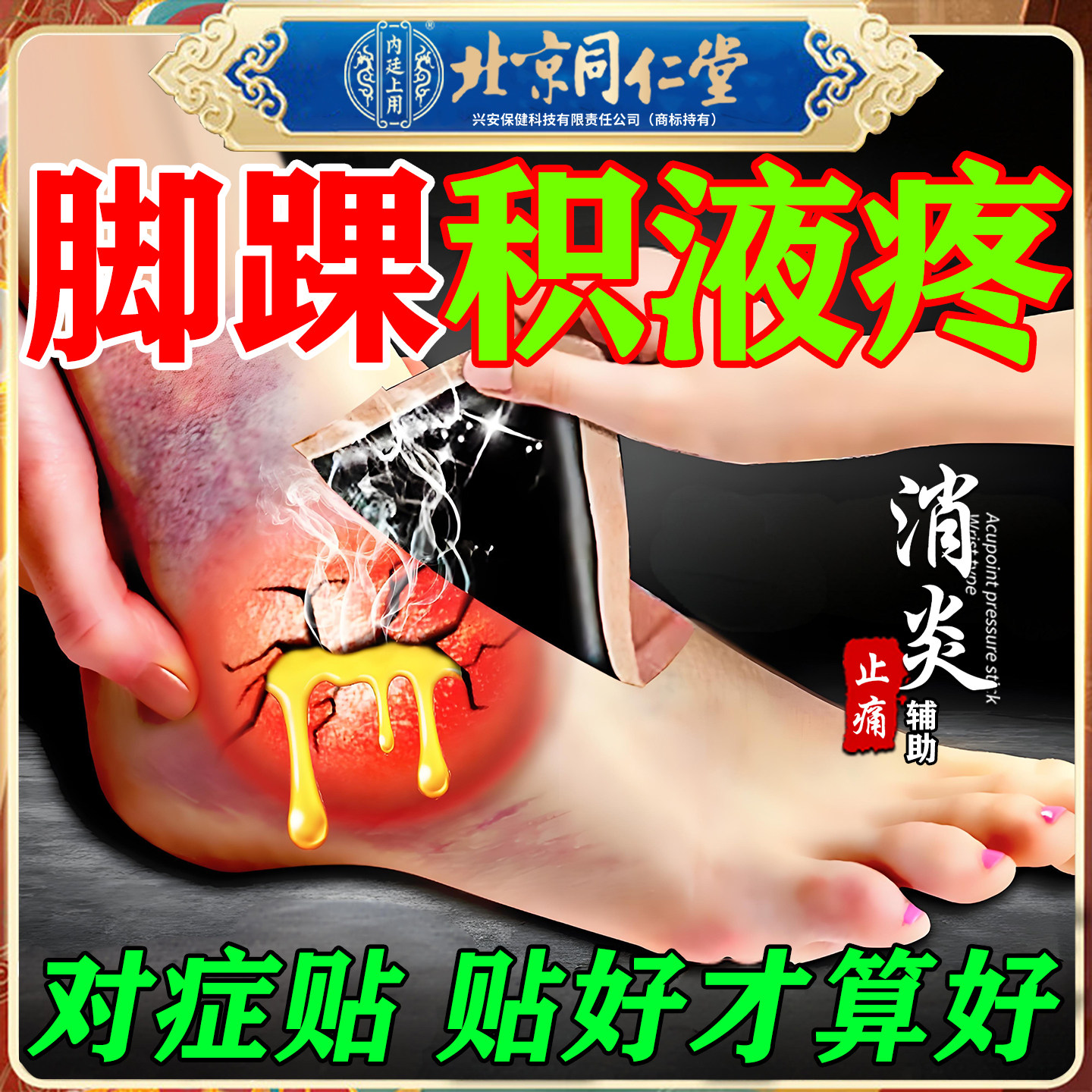 脚踝积液消专用除膏药贴脚腕滑膜炎关节疼痛肿胀崴脚扭伤韧带撕裂