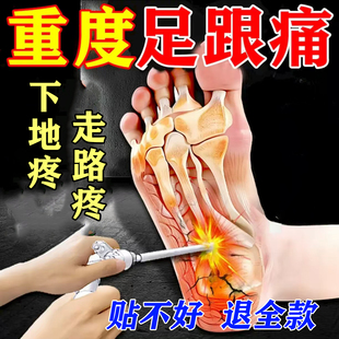 足跟痛足底筋膜炎骨刺脚后跟疼膏药脚底板疼痛走路疼下地疼专用贴