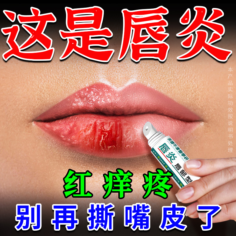 唇炎润唇膏嘴唇干裂脱皮水泡红肿非专用保湿滋润死皮口角炎润唇膏