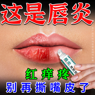唇炎润唇膏嘴唇干裂脱皮水泡红肿非专用保湿滋润死皮口角炎润唇膏