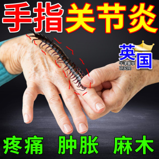 手指关节炎膏药贴引起手指疼痛红肿麻木僵硬变形类风湿骨性关节炎