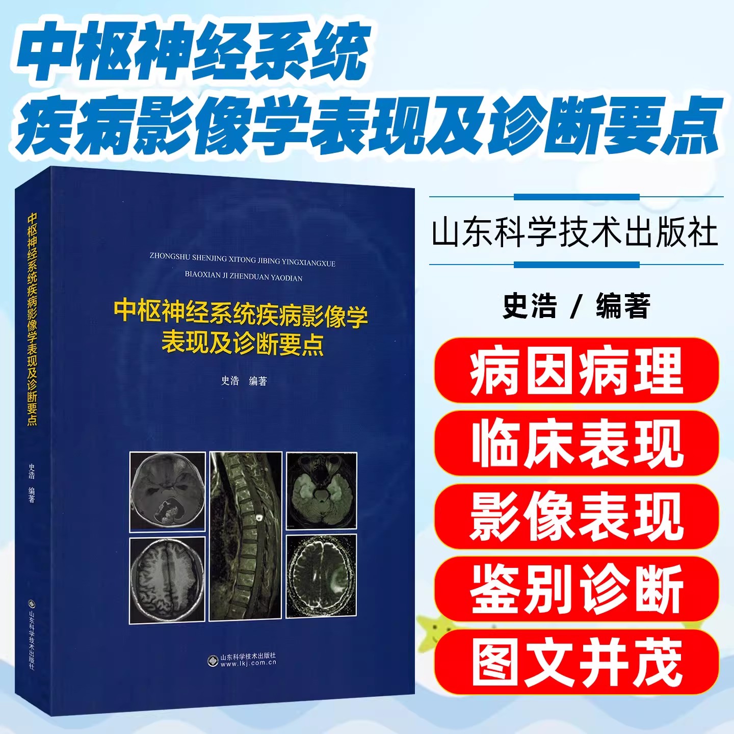中枢神经系统疾病影像学表现及诊断要点史浩影像医学山东科学技术出版社提升影像诊断实操能力典型影像图谱看清中枢神经诊断要点