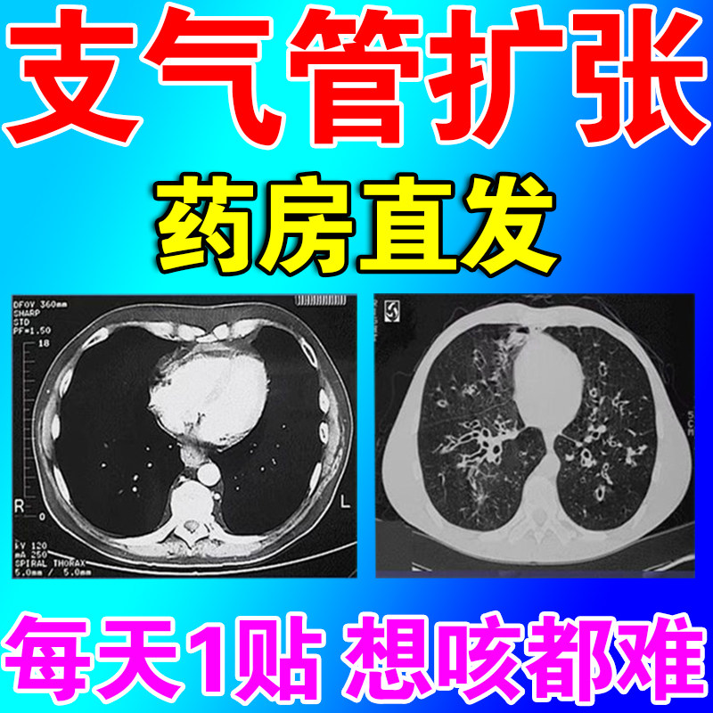 支气管炎贴扩张止咳化痰润肺消炎哮喘急慢性小儿喉咙痒干咳嗽中药