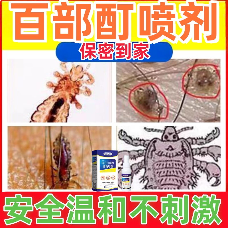 百部酊灭阴虱虱子专用药虫卵双杀男女士私处虱子螨虫正品抑菌喷剂