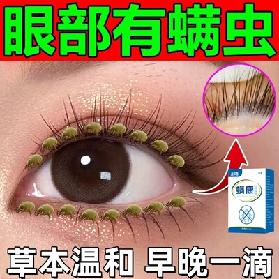 【快速去除】眼睛除螨虫专用眼液