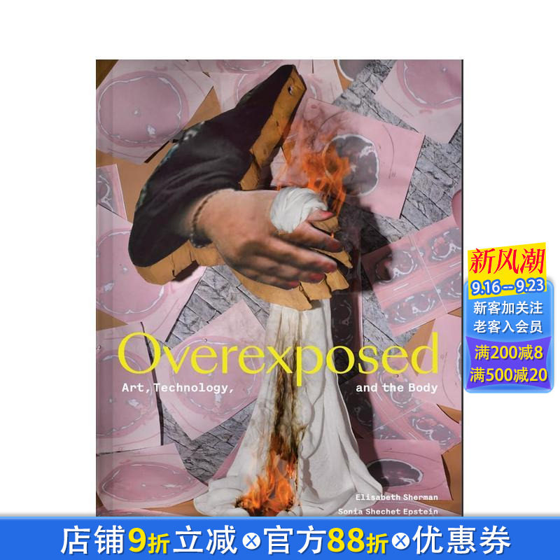 【预售】过度曝光：艺术、技术与身体 医学影像技术作品集 Overexposed:Art，Technology，and the Body 英文艺术画册正版进口书