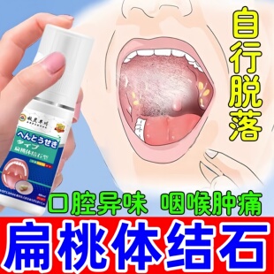 扁桃体结石去除工具隐窝冲洗器漱口水清理口腔臭异味吸引神器喷剂