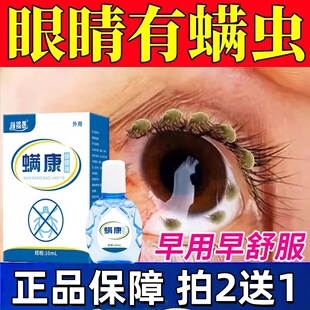 眼部除螨眼药眼睛水去螨虫眼脸清洁眼角血丝异物感专用洗眼液正品
