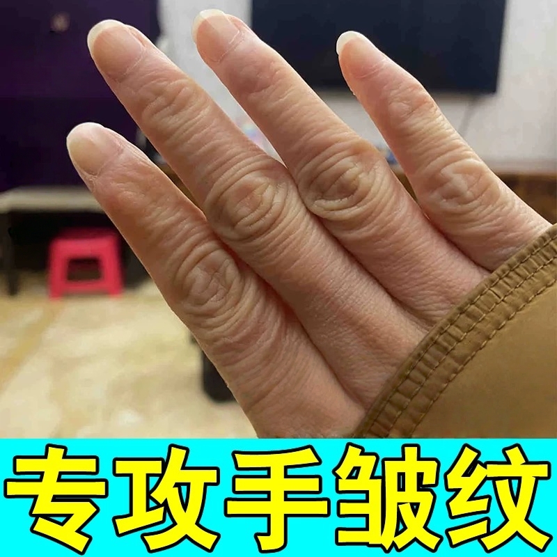 护手霜美白保湿嫩白去手纹手指关节皱纹暗沉粗糙治疗手背黑专用药