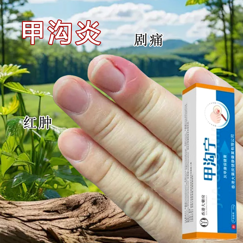 甲沟炎治疗专用药非特效药膏息肉去除嵌甲克星脱指甲刀液软化剂勾
