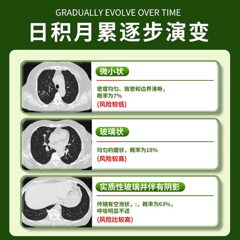 槲皮素清肺润肺散结节丸肺治疗消除中成I药蒲公英散结茶药官方正,传统滋补营养品,养生丸,淘宝优惠券,粉丝福利购,淘宝优惠卷