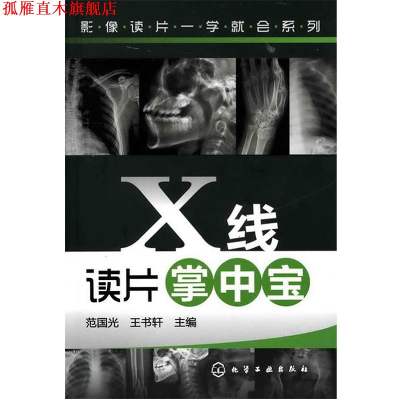 【正版书】 影像读片一学就会系列--X线读片掌中宝 范国光,王书轩 主编 化学工业出版社