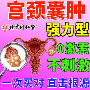 宫颈纳囊的可搭配膏药贴氏宫颈囊肿肥治疗修复息肉糜烂多囊卵巢EW