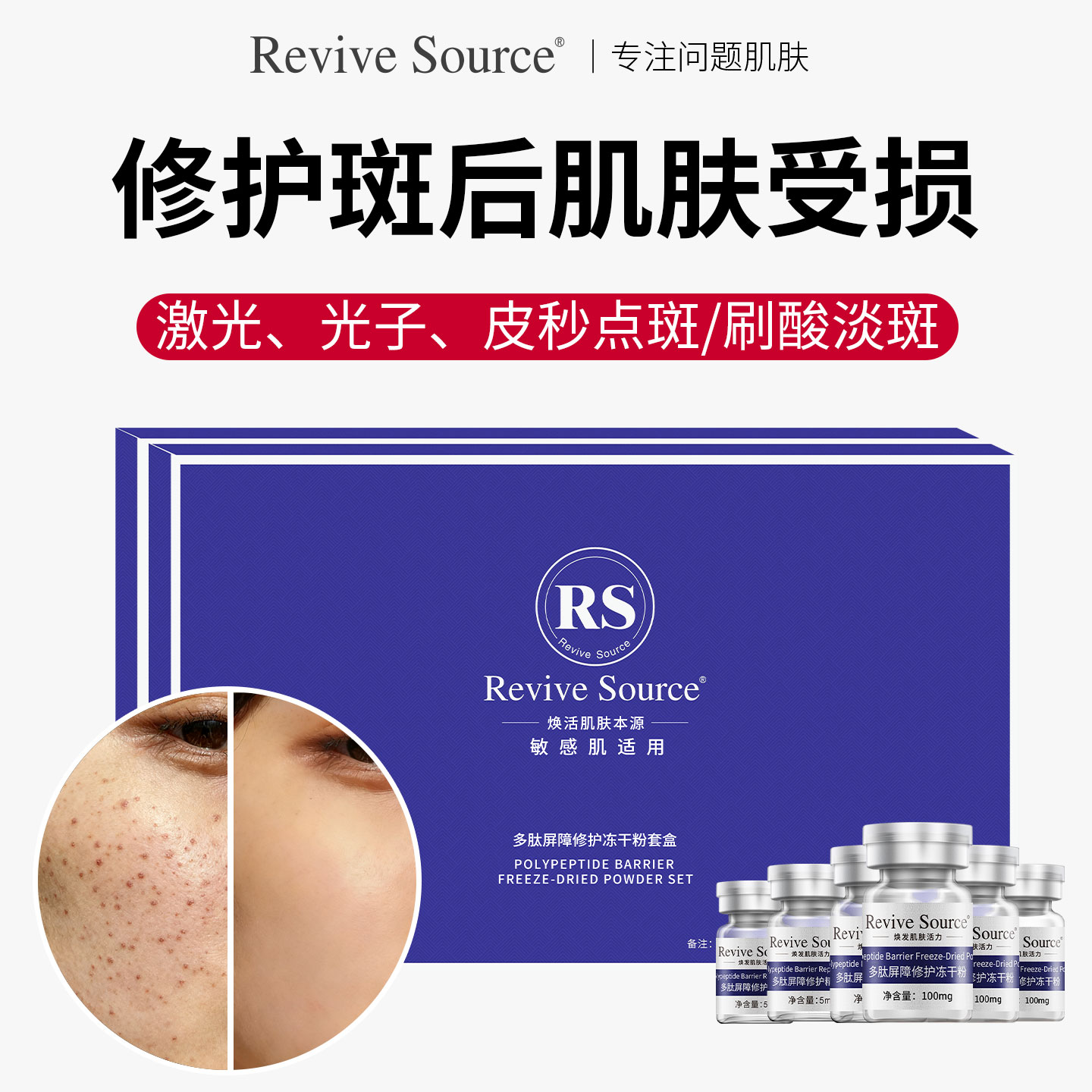 冻干粉修护点痣后修复膏屏障受损