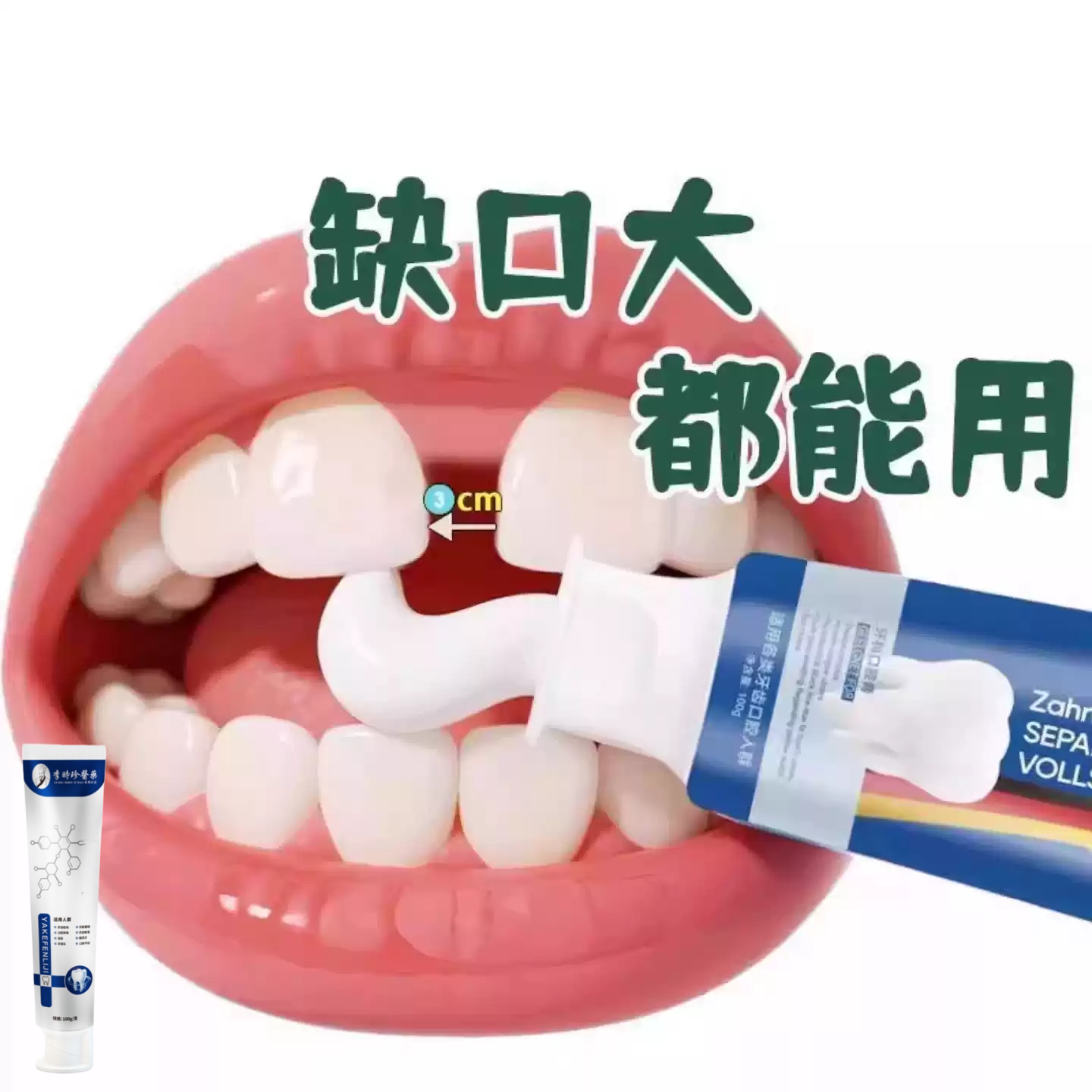 【严重牙窟窿】牙齿有洞蛀牙智齿吃肉塞牙牙膏正品 老少通用