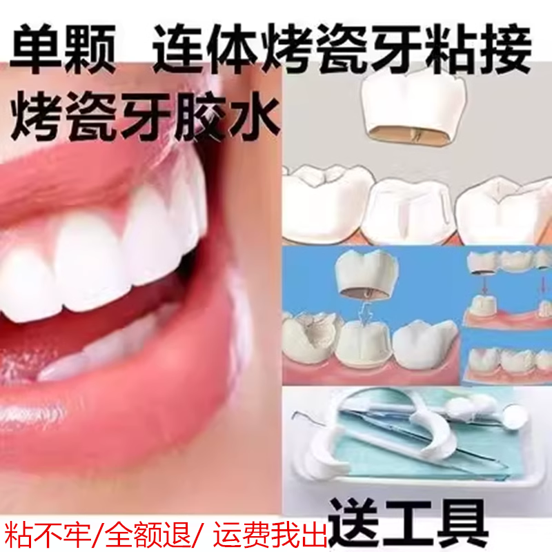 牙科自己动手粘烤瓷牙胶水牙齿钢6863口腔科材料