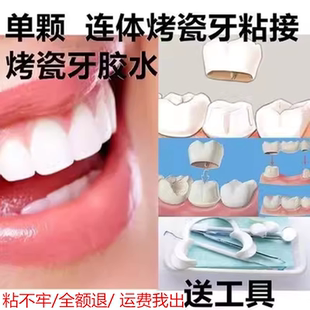 牙科自己动手粘烤瓷牙胶水牙齿钢牙套牙冠假牙专用牙科胶水粘接剂