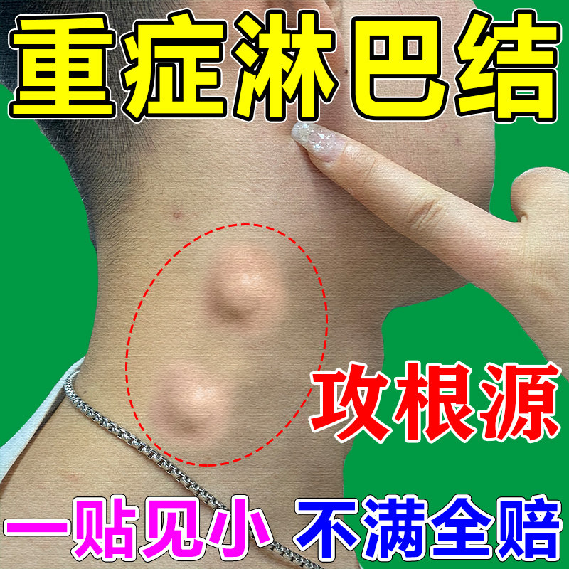 淋巴排毒脖子疏通神器颈部淋巴结肿大散结消炎贴膏腋下去副乳专用