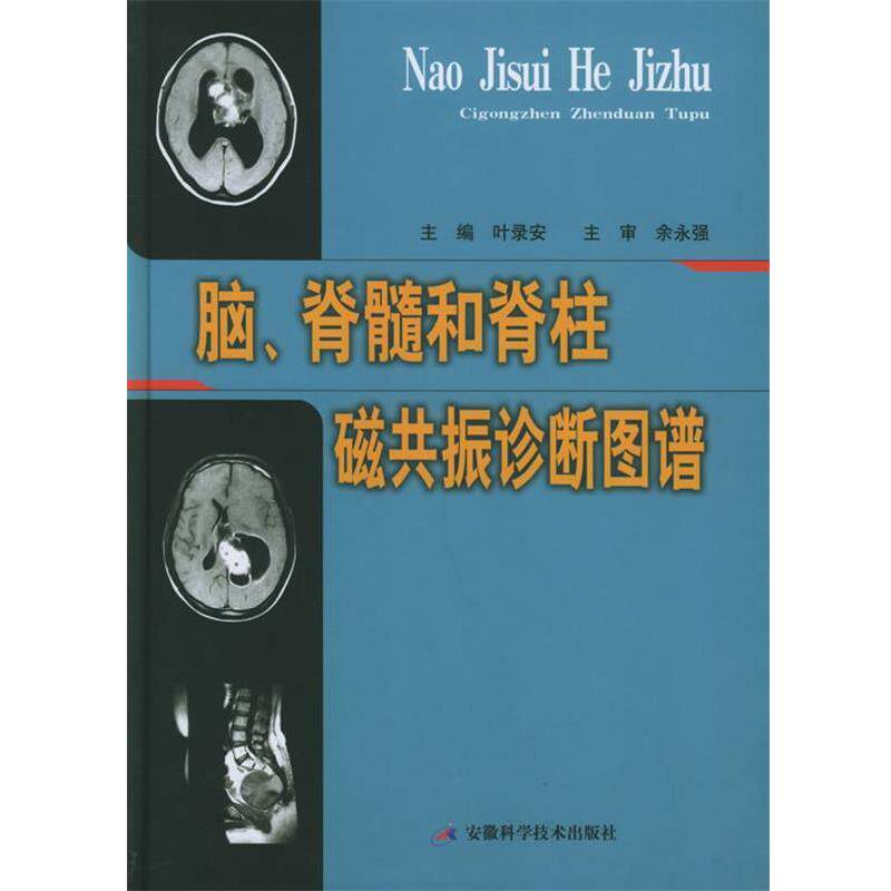 【正版书】 脑、脊髓和脊柱磁共振诊断图谱 叶录安 主编 安徽科学技术出版社